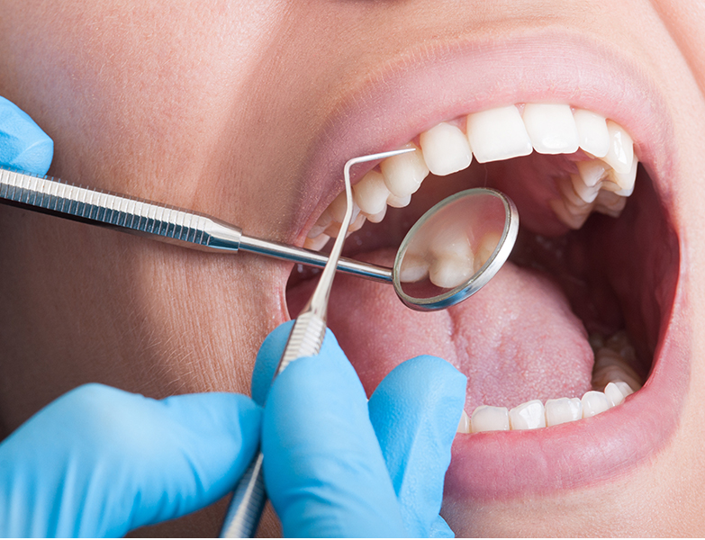 Dentist cleaning perfect teeth of a beautiful mouth female